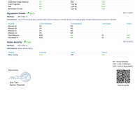 Blackberry CBD Gummies (THC-Free, Vegan) - 3 Sizes